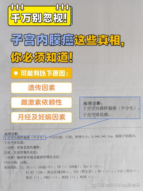 Novotech 发布子宫内膜癌研究报告,是妇科恶性肿瘤死亡的主要原因之一