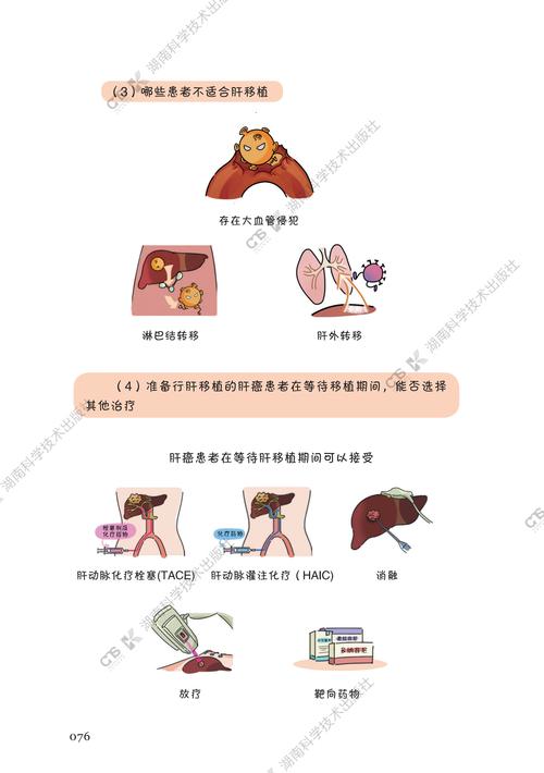 移植物抗宿主病日:移植术后并发症不容忽视 把握早筛早诊早治“黄金期”